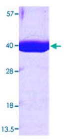 SDS-PAGE (MDH2-4499H).jpg
